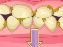 Bad Teeth Makeover thumbnail